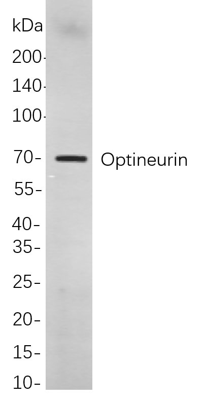 Recombinant Optineurin Monoclonal Antibody-searchlist-1