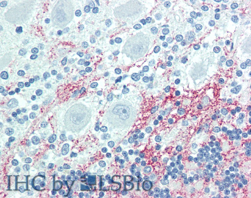 Immunohistochemistry of paraffin-embedded Brain, Cerebellum tissue using GJB6 Polyclonal Antibody at dilution of 1:100(Elabscience Product Detected by Lifespan).