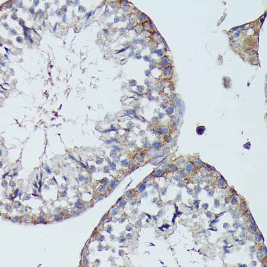 Immunohistochemistry of paraffin-embedded Mouse testis using SLC7A2 Polyclonal Antibody at dilution of 1:100 (40x lens).