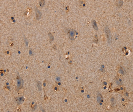 Immunohistochemistry of paraffin-embedded Human brain  tissue using PLXNA1 Polyclonal Antibody at dilution 1:30