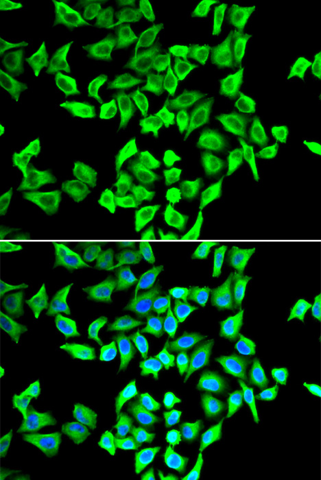 Immunofluorescence analysis of A549 cells using p53 Polyclonal Antibody