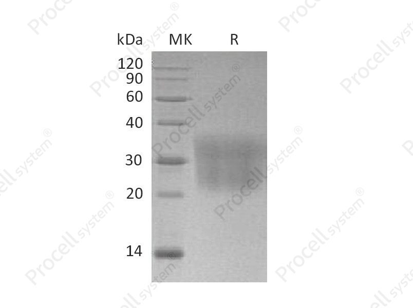 MCP-1/CCL2 (C-6His), Mouse, Recombinant