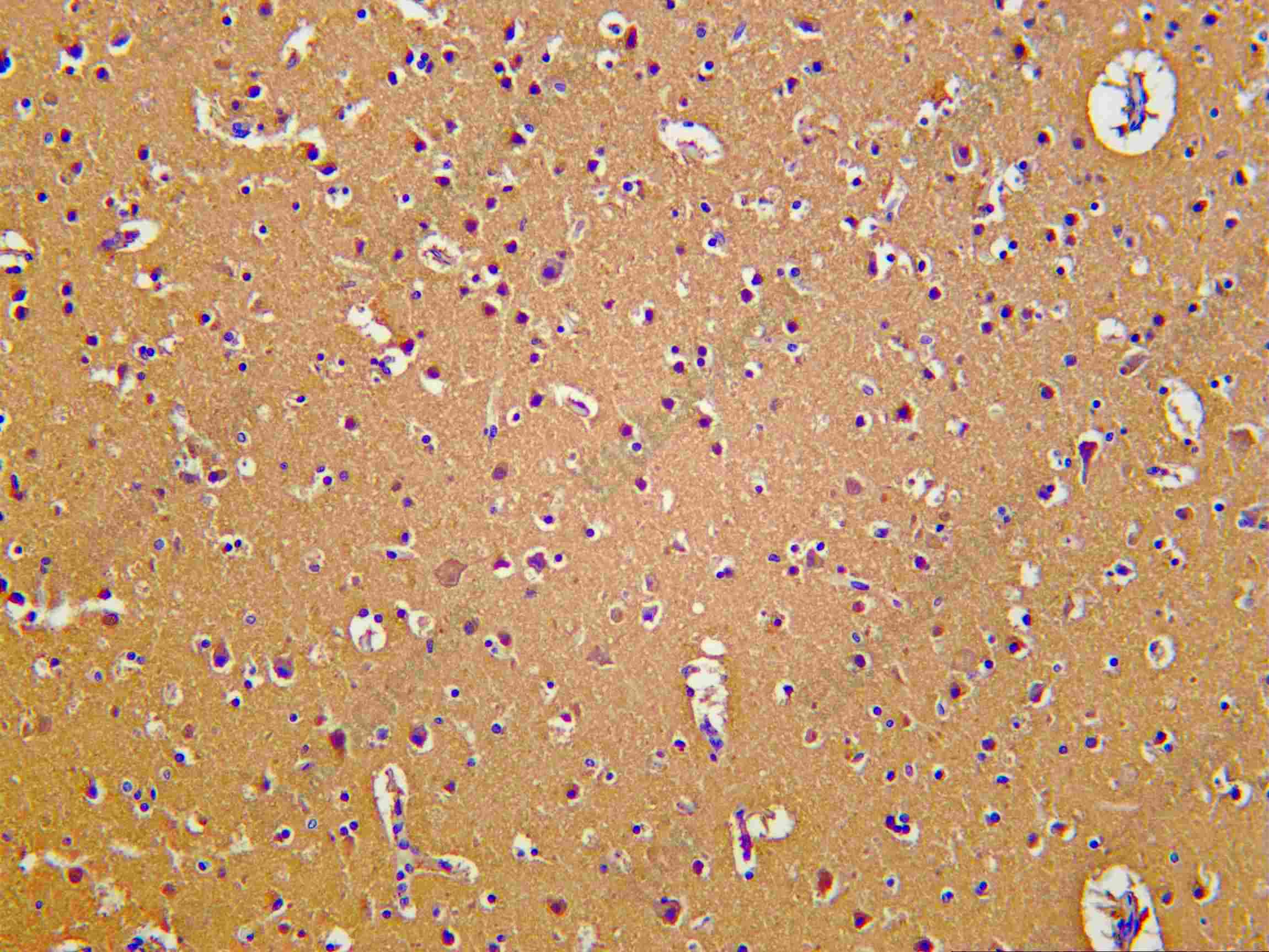 Recombinant TF Monoclonal Antibody - 1