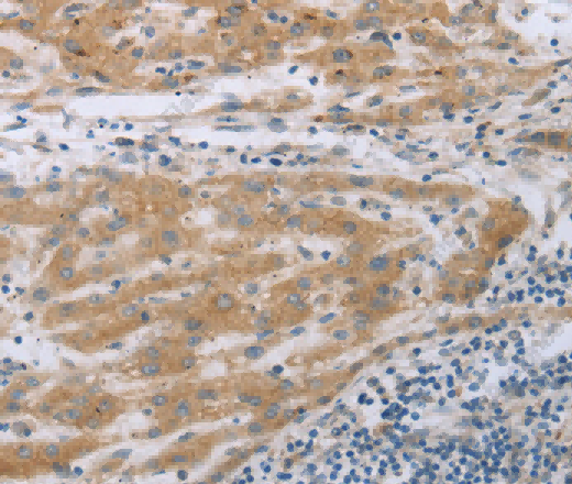 TNK2 Polyclonal Antibody - 3