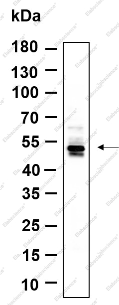 Recombinant Phospho-CaMKII α, β (Thr286) Monoclonal Antibody - 1