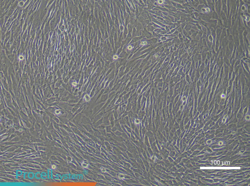 Human Cardiac Fibroblast (Primary cell immortalization) Complete MediumHuman Cardiac Fibroblast (Primary cell immortalization) Complete Medium - 3