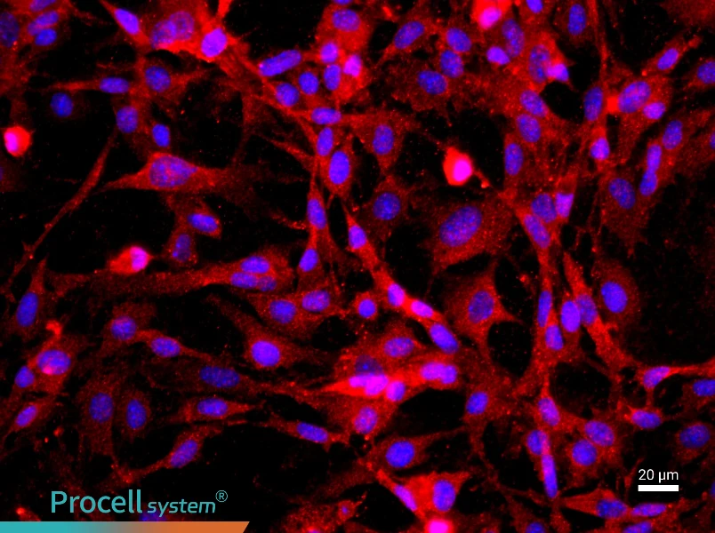 Mouse Cavernous Endothelial Cell Complete Medium - 2