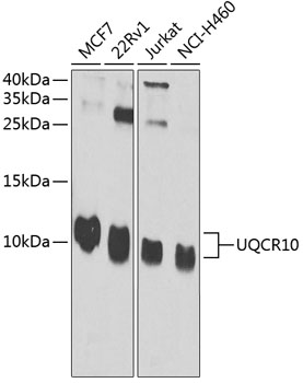 Western blot analysis of extracts of various cell lines using UQCR10 Polyclonal Antibody at 1:1000 dilution.