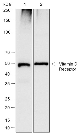 Recombinant Vitamin D Receptor Monoclonal Antibody-searchlist-1