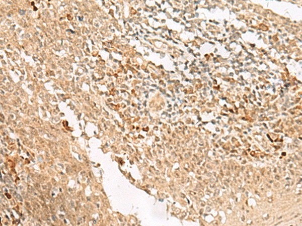 Immunohistochemistry of paraffin-embedded Human tonsil tissue  using HUS1 Polyclonal Antibody at dilution of 1:45(?200)