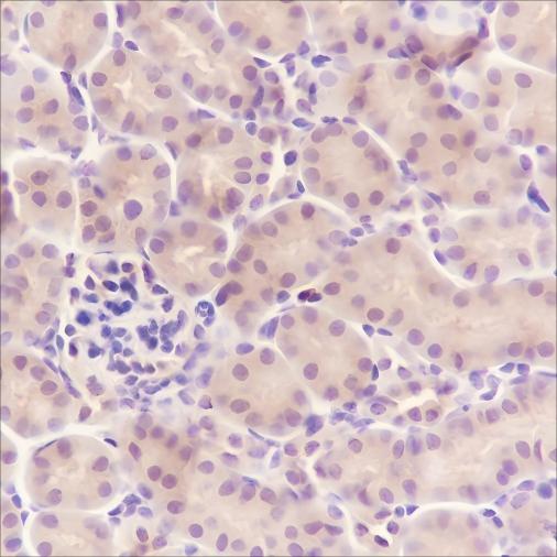 Recombinant SBDS Monoclonal Antibody - small - 4
