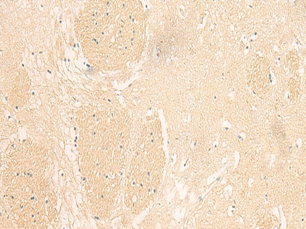 Immunohistochemistry of paraffin-embedded Human brain tissue  using IL37 Polyclonal Antibody at dilution of 1:50(?200)