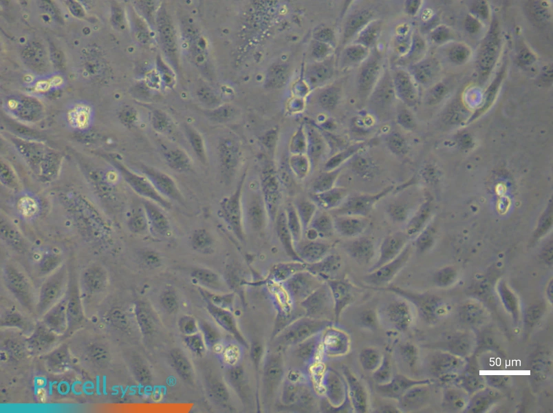 Human Umbilical Vein Endothelial (Primary cell immortalization) Cell Complete Medium - 5