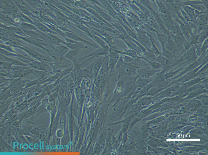 Human Lung Fibroblast Complete Medium - small - 6