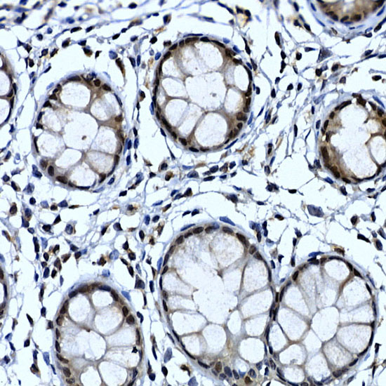 Immunohistochemistry of paraffin-embedded human colon using NELFCD Polyclonal Antibody at dilution of 1:50 (40x lens).Perform high pressure antigen retrieval with 10 mM citrate buffer pH 6.0 before commencing with IHC staining protocol.