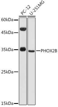 Western blot analysis of extracts of various cell lines using PHOX2B Polyclonal Antibody at 1:1000 dilution.