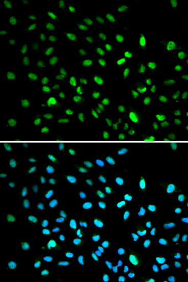 Immunofluorescence analysis of A549 cells using DDIT3 / CHOP Polyclonal Antibody