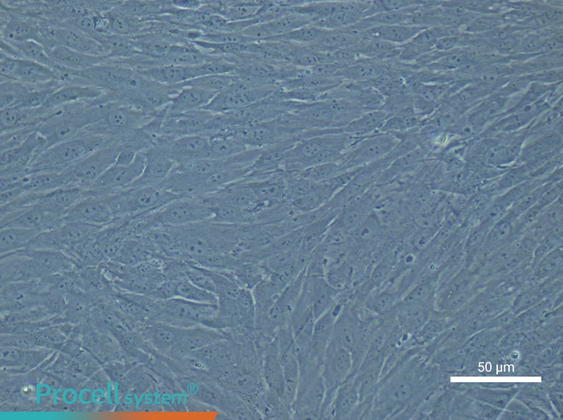 Human Cardiac Fibroblast Complete Medium - 6