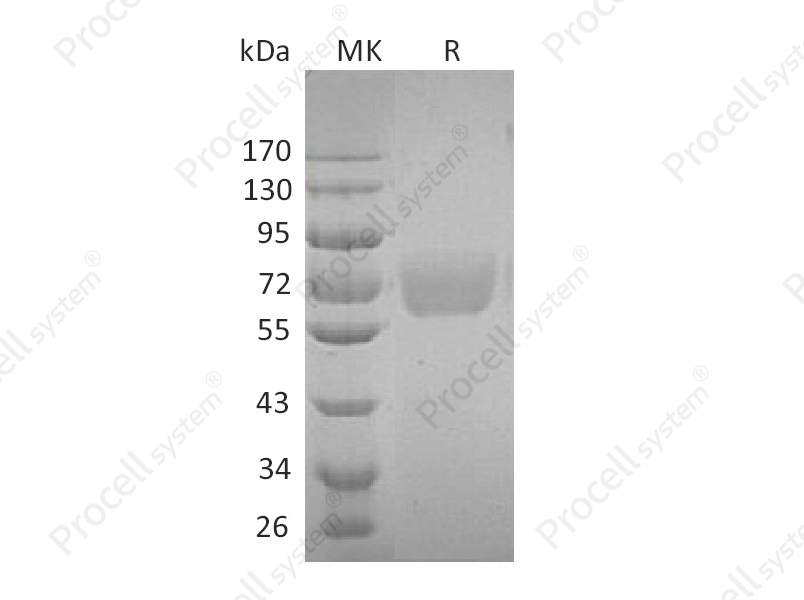IL-4R&alpha;/CD124 (C-Fc), Human, Recombinant