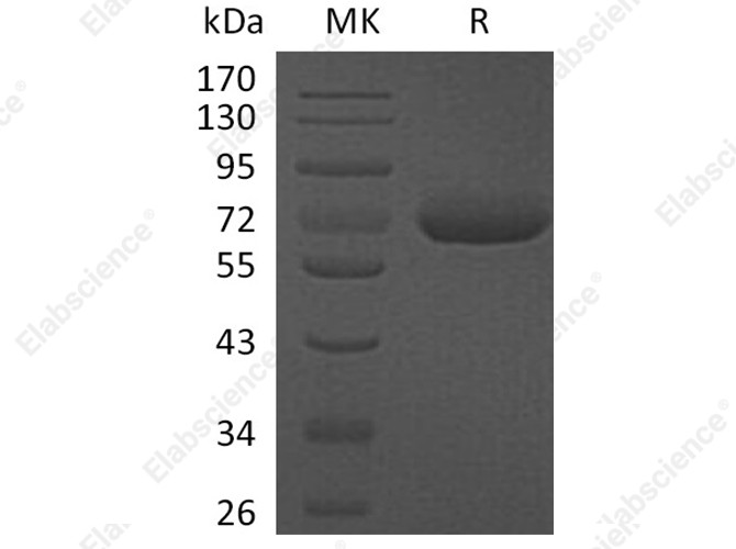 Recombinant Human CFHR5 Protein (His Tag) - 1