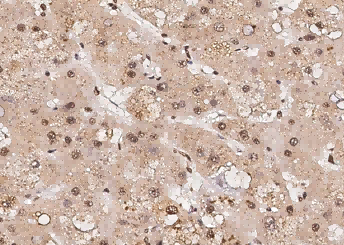 RPRD1B Monoclonal Antibody - small - 1