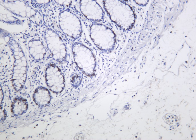 Recombinant MCM2 Monoclonal Antibody-searchlist-1