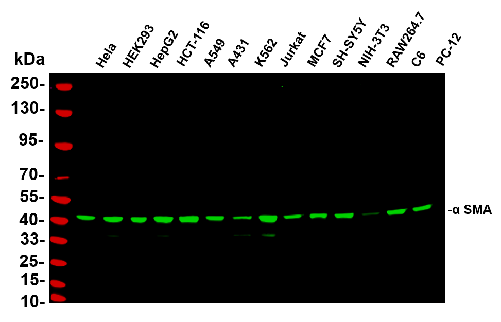 Recombinant α smooth muscle actin Monoclonal Antibody-searchlist-1