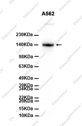 Recombinant TrkA/NTRK1 Monoclonal Antibody - 2