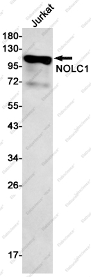 Recombinant NOLC1 Monoclonal Antibody - 1