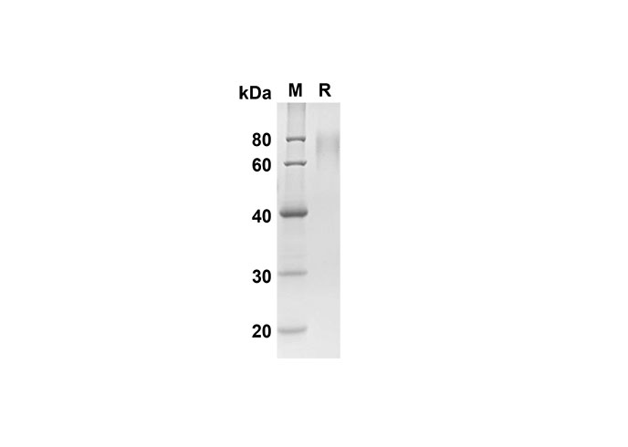 Recombinant Rat IL-1b Protein(Trx Tag)-产品推荐-1
