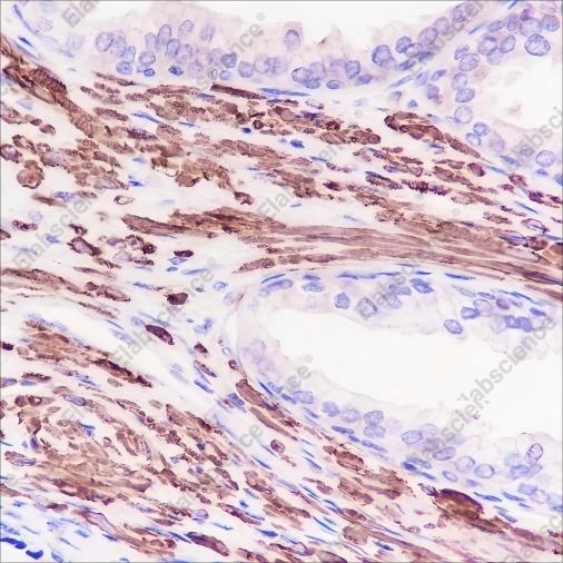 Recombinant alpha smooth muscle Actin Monoclonal Antibody - 3