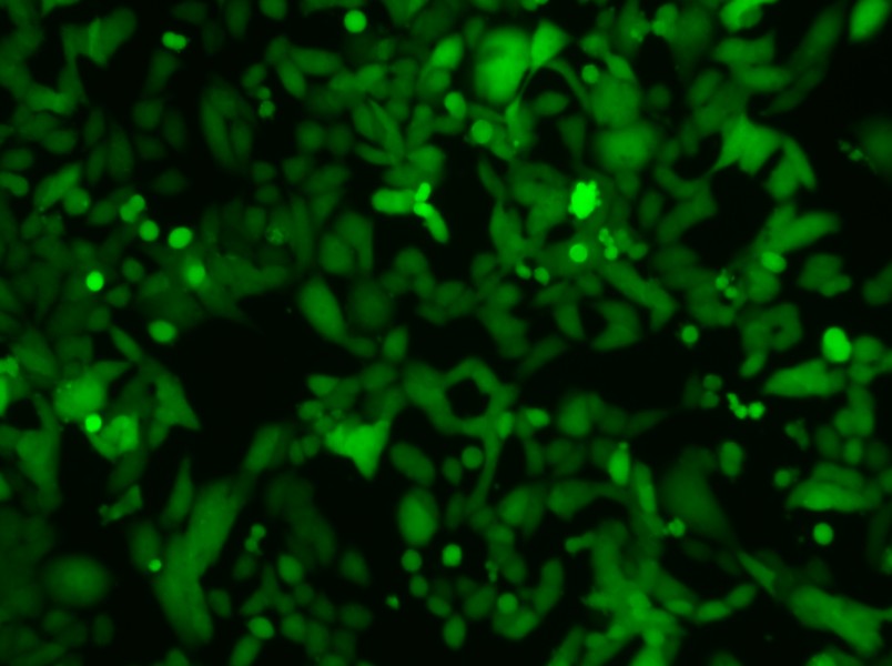 NCI-H446-LUC-EGFP Cell Complete Medium - 9