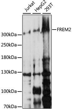 Western blot analysis of extracts of various cell lines using FREM2 Polyclonal Antibody at 1:1000 dilution.