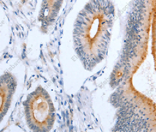 PLAUR Polyclonal Antibody - 3