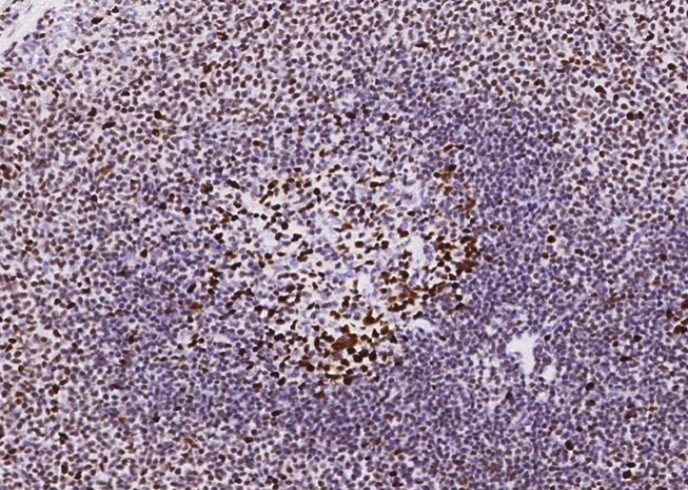 Recombinant MSH6/GTBP Monoclonal Antibody - small - 10