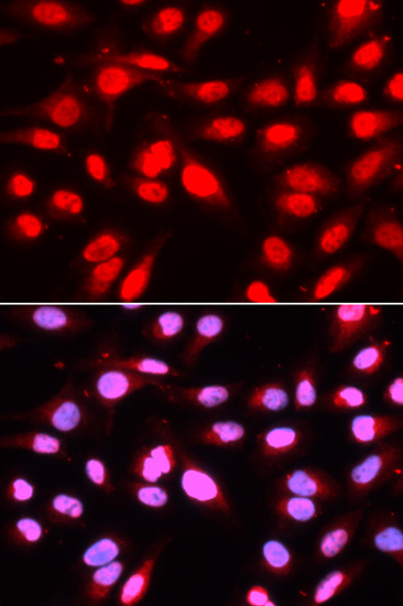 Immunofluorescence analysis of U2OS cells using U2AF2 Polyclonal Antibody