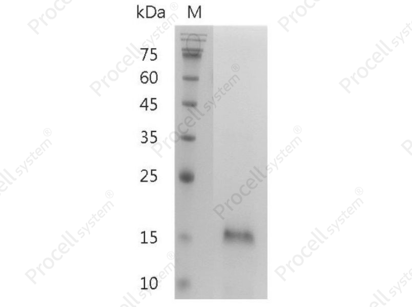 IL-25/IL-17E/Il17e, Mouse, Recombinant