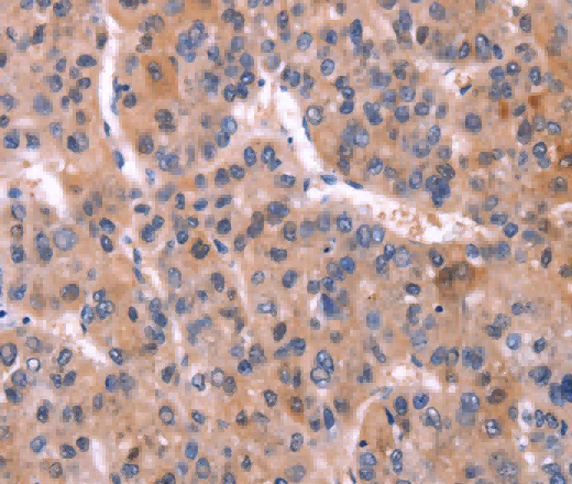 CD269 Polyclonal Antibody - 3