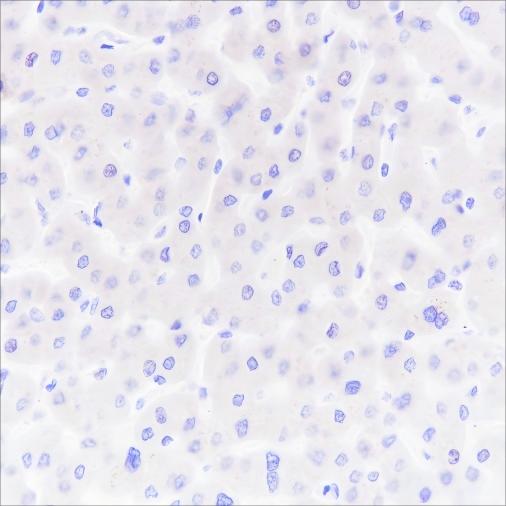 Recombinant PAP Monoclonal Antibody - small - 3