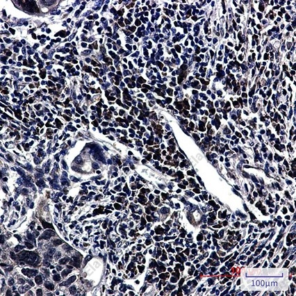 Recombinant HNRNPUL1 Monoclonal Antibody - 3