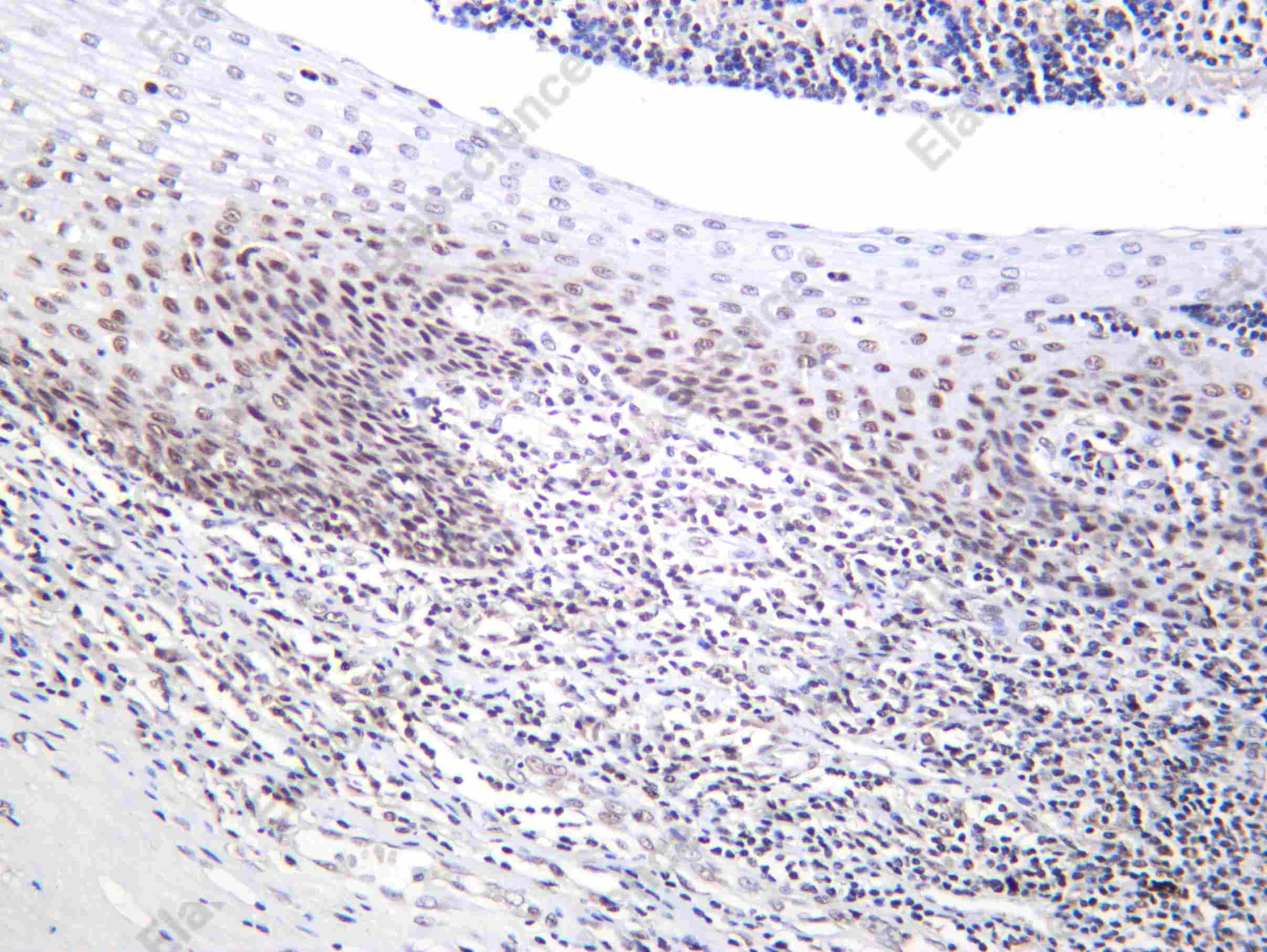 Recombinant BCKDK Monoclonal Antibody - 1