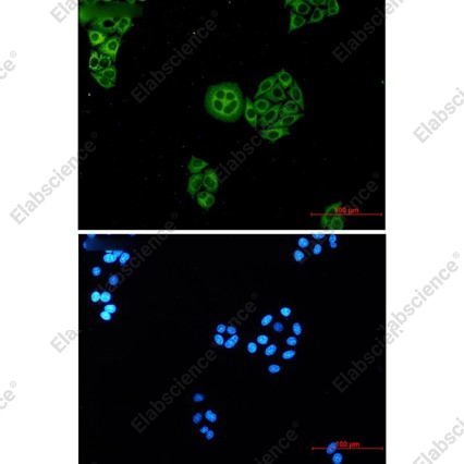 Recombinant WDR1 Monoclonal Antibody - 2