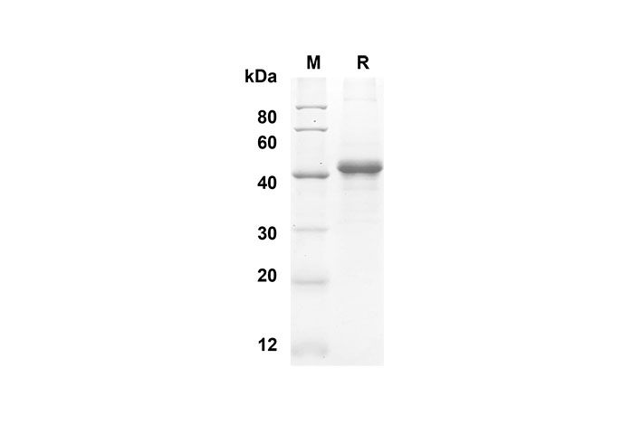 Recombinant Human CCL27/CTACK Protein(Sumo Tag)-产品推荐-1