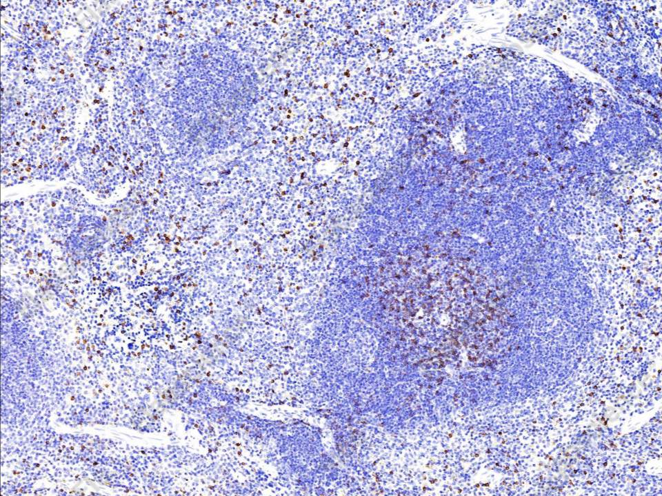 Recombinant CD8B/P37/LEU2 Monoclonal Antibody - 1