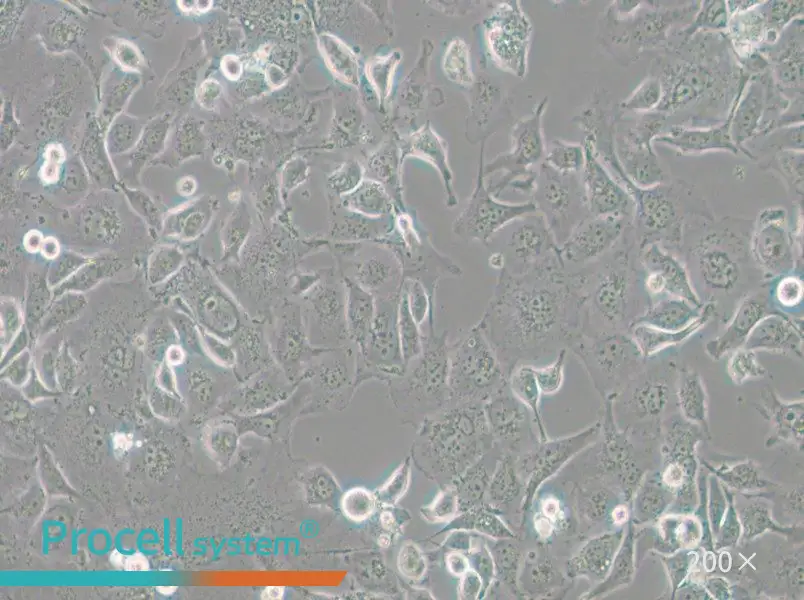 Anglne Cell Complete Medium - small - 6