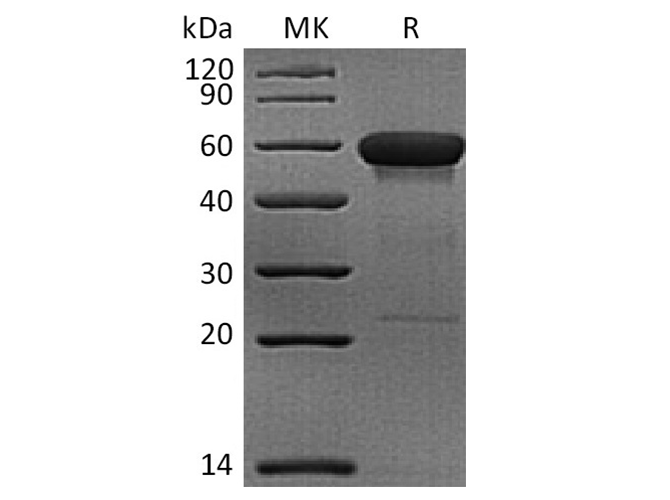 Recombinant Rhesus macaque CD160 Protein (Fc Tag)