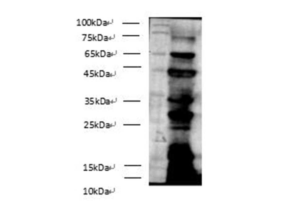 Western blotting of anti-Pan Acetyl-Lysine polyclonal antibody on E.coli lysates at dilution of 1:500.