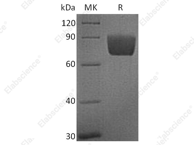 Recombinant Human B7-H4/VTCN1 Protein (Fc Tag) - 1