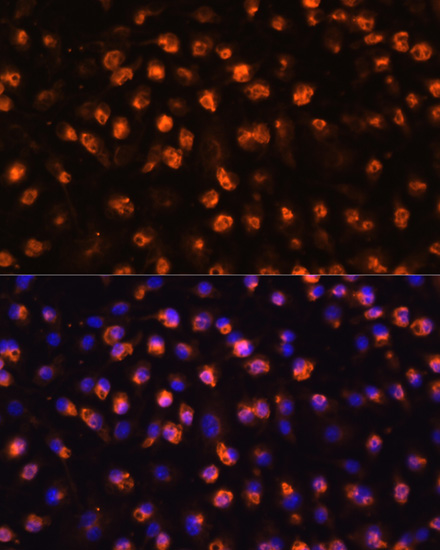 Immunofluorescence analysis of RAW264.7 cells using CD11B Polyclonal Antibody at dilution of  1:100. Blue: DAPI for nuclear staining.