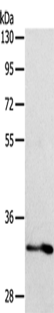 Western Blot analysis of Human fetal intestine tissue using ST2 Polyclonal Antibody at dilution of 1:700